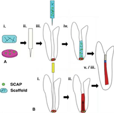 Biomaterials and Scaffold Design Strategies for Regenerative <mark class="highlighted">Endodontic</mark> Therapy